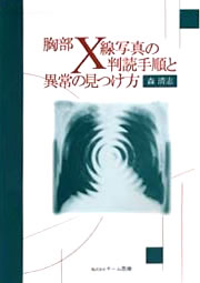 xline xline